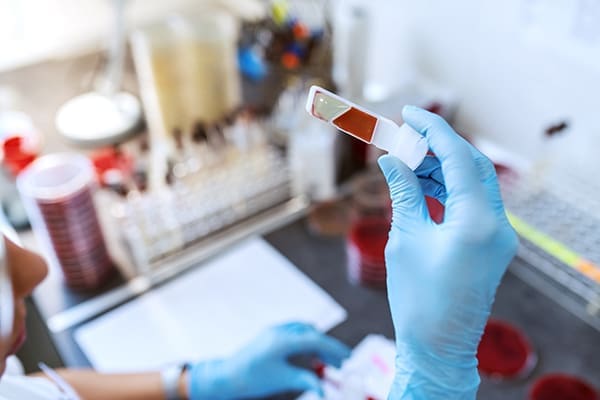 Chronic Blood Cancer