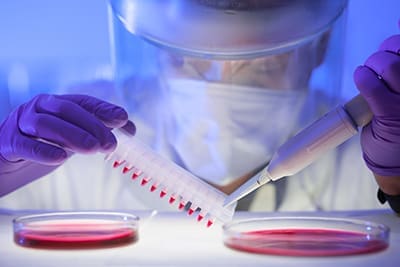 Chronic Lymphocytic Leukaemia